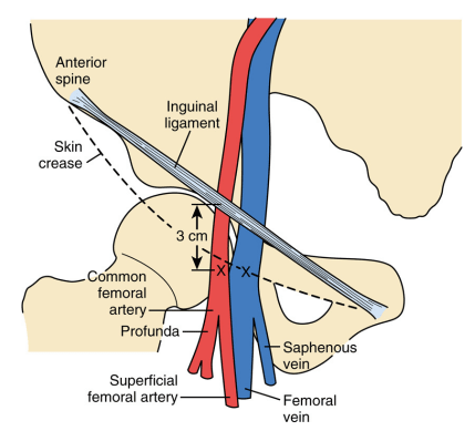 Kaplan's Cardiac Anesthesia 8th Edition2