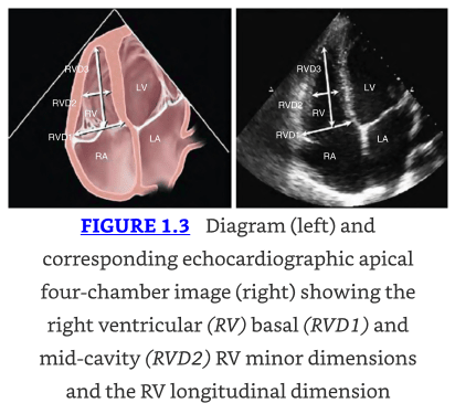 Kaplan's Cardiac Anesthesia 8th Edition4