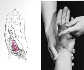 Músculos. Pruebas Funcionales. Postura y Dolor2