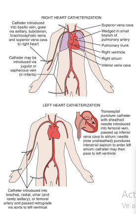 Kern's Cardiac Catheterization Handbook 8th Edition6