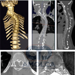 Ortopedia Pediatrica de Lowell & Winter 2 vols. 7° edición8
