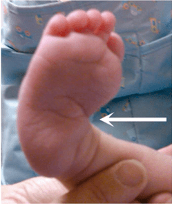 Ortopedia Pediatrica de Lowell & Winter 2 vols. 7° edición4