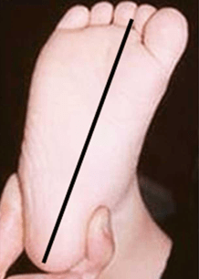 Ortopedia Pediatrica de Lowell & Winter 2 vols. 7° edición3