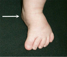 Ortopedia Pediatrica de Lowell & Winter 2 vols. 7° edición2