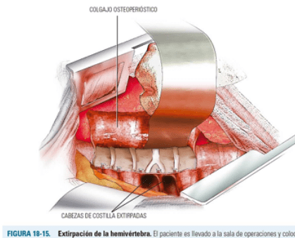 Ortopedia Pediatrica de Lowell & Winter 2 vols. 7° edición5