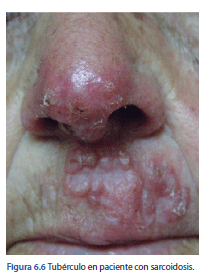 Manual de Psicodermatologia Malvido - Torales - Vasquez5