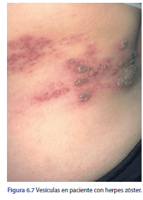 Manual de Psicodermatologia Malvido - Torales - Vasquez4