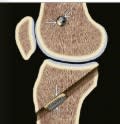 Manaster, Diagnostico por Imagenes Musculoesqueletico 2: Enfermedades no traumaticas5