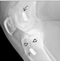 Manaster, Diagnostico por Imagenes Musculoesqueletico 2: Enfermedades no traumaticas4