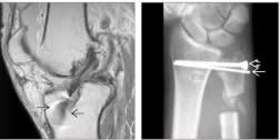Manaster, Diagnostico por Imagenes Musculoesqueletico 2: Enfermedades no traumaticas3