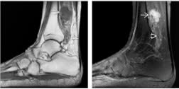Manaster, Diagnostico por Imagenes Musculoesqueletico 2: Enfermedades no traumaticas2
