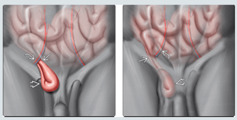FEDERLE, Imagenes en Gastroenterologia5