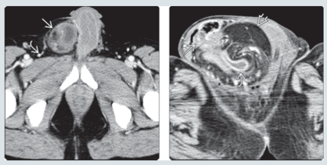 FEDERLE, Imagenes en Gastroenterologia4