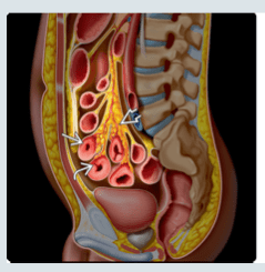 FEDERLE, Imagenes en Gastroenterologia3