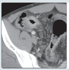 FEDERLE, Imagenes en Gastroenterologia2