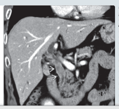 FEDERLE, Imagenes en Gastroenterologia1