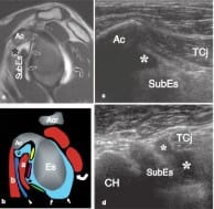 Bianchi Martinoli Ecografía Musculoesquelética 2 vols3