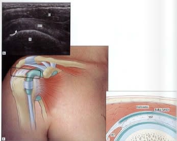 McNally, Ultrasonografia musculoesqueletica2