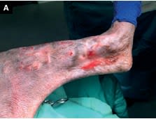 Manejo integral de las infecciones en ortopedia y traumatología en pequeños animales5