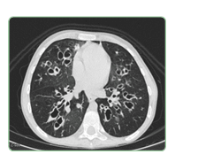 Manual de Enfermedades Respiratorias Pediátricas - Guillermo Zepeda2