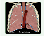 Manual de Enfermedades Respiratorias Pediátricas - Guillermo Zepeda - ENTREGA DIFERIDA1