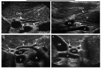 Middleton, Ecografia Handbook5