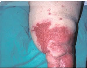 Miller Ortopedia en Medicina Deportiva. DeLee y Brez, 2 Vols. + Acceso Online6