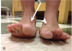 Miller Ortopedia en Medicina Deportiva. DeLee y Brez, 2 Vols. + Acceso Online3