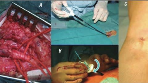Martin Moreiras, Manual de Hemodinamica e Intervencionismo Cardiaco4
