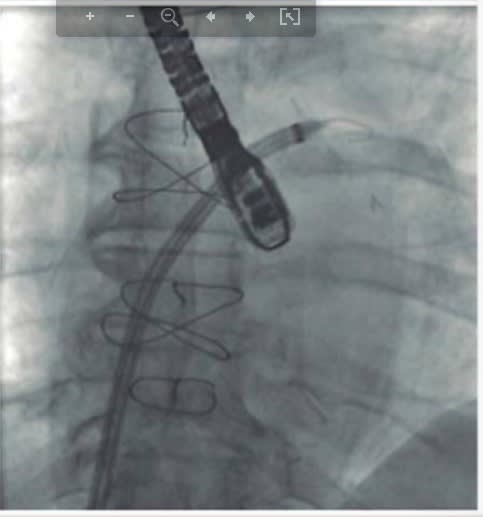 Martin Moreiras, Manual de Hemodinamica e Intervencionismo Cardiaco5