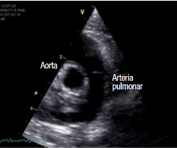 Novellas , Diagnostico ecografico en el gato4