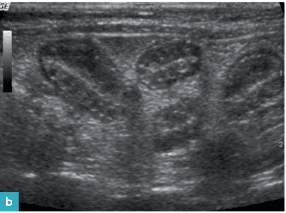 Novellas , Diagnostico ecografico en el gato3