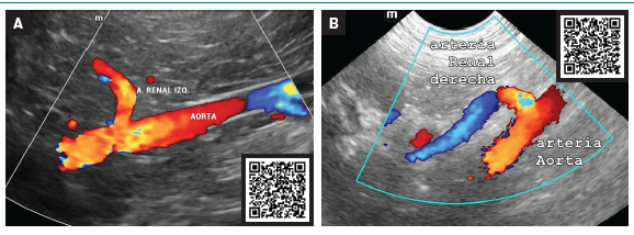 Atlas clinico de ecografia doppler en pequeños animales2