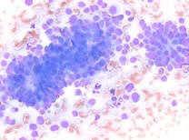 Oncologia practica para el clinico de Pequeños Animales 2a edición - Ruano5