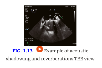 Textbook of Clinical Echocardiography, 7th Edition Catherine M. Otto4