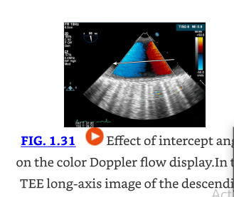 Textbook of Clinical Echocardiography, 7th Edition Catherine M. Otto3