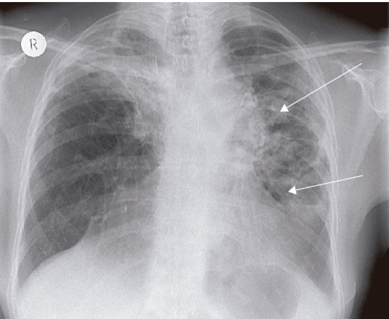 Guia Practica Churchill de Diagnostico Diferencial2