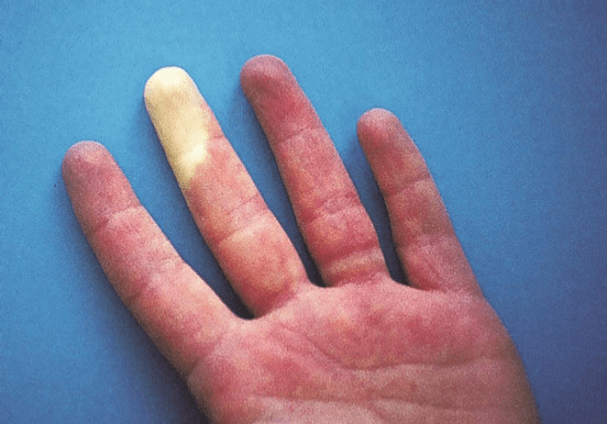 Guia Practica Churchill de Diagnostico Diferencial3