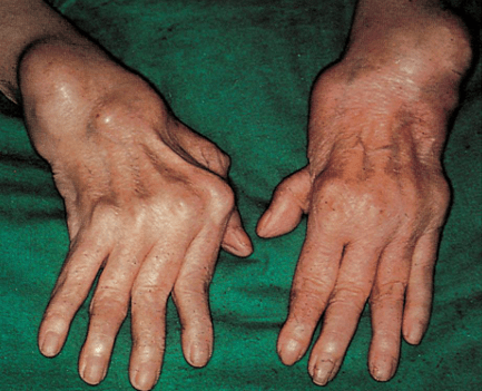 Guia Practica Churchill de Diagnostico Diferencial4