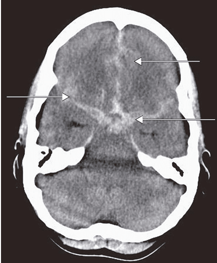 Guia Practica Churchill de Diagnostico Diferencial5