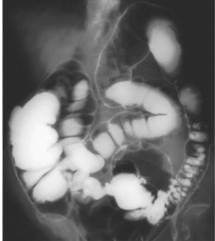 Guia Practica Churchill de Diagnostico Diferencial6