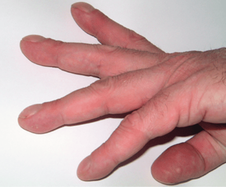 Guia Practica Churchill de Diagnostico Diferencial7