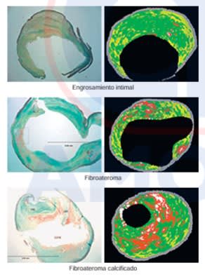 RUTHERFORD Cirugia Vascular y Terapia Endovascular 9° ed. Arterial - Sidawy1