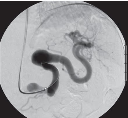RUTHERFORD Cirugia Vascular y Terapia Endovascular 9° ed. Arterial - Sidawy4