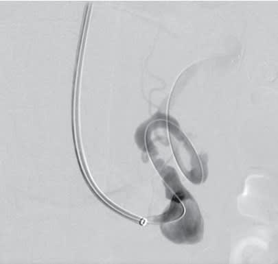 RUTHERFORD Cirugia Vascular y Terapia Endovascular 9° ed. Arterial - Sidawy3