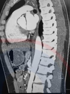Rutherford. Cirugia vascular y Terapia Endovascular 9 Ed. Venoso2