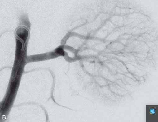 Rutherford. Cirugia vascular y Terapia Endovascular 9 Ed. Venoso6
