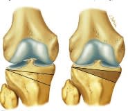 Sanchez Cartilago Articular2