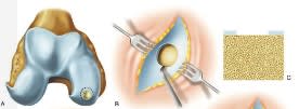 Sanchez Cartilago Articular5