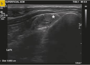 Ortopedia en pequeños animales. El miembro anterior4